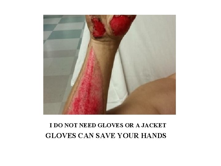 I DO NOT NEED GLOVES OR A JACKET GLOVES CAN SAVE YOUR HANDS 