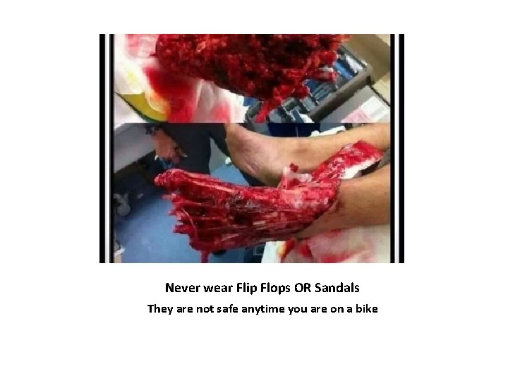 Never wear Flip Flops OR Sandals They are not safe anytime you are on