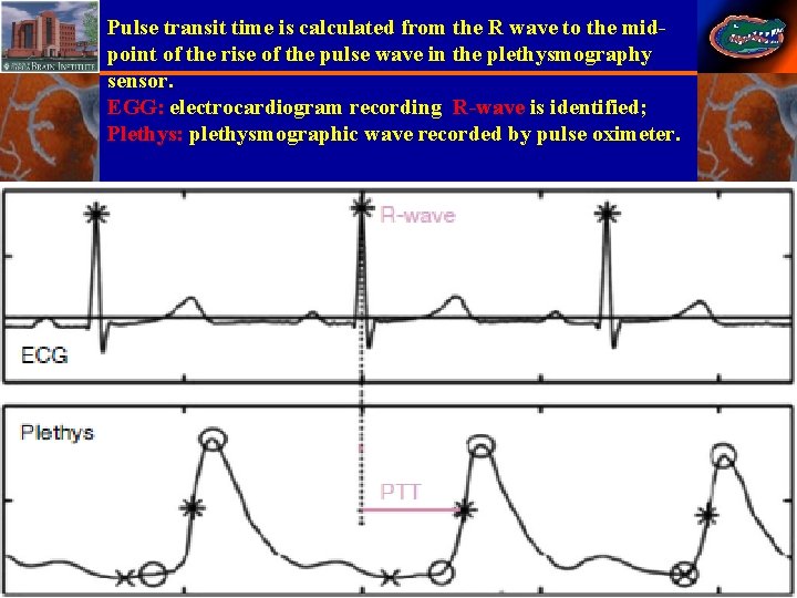 Pulse transit time is calculated from the R wave to the midpoint of the