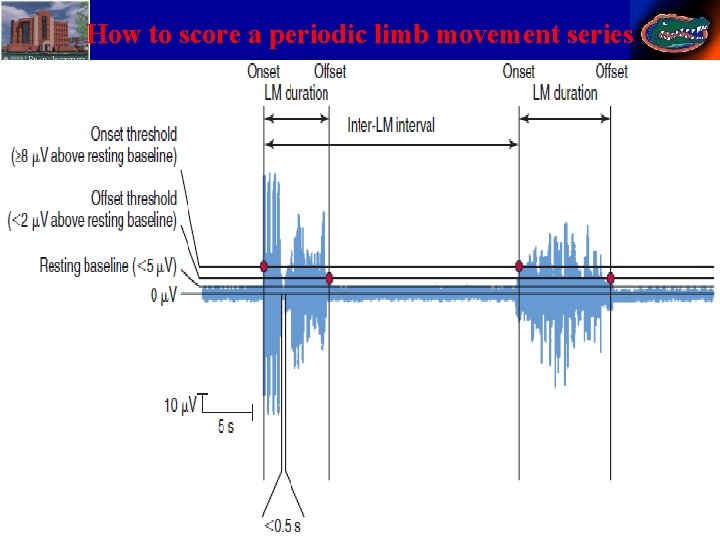 How to score a periodic limb movement series 41 Stephan Eisenschenk, MD Department of
