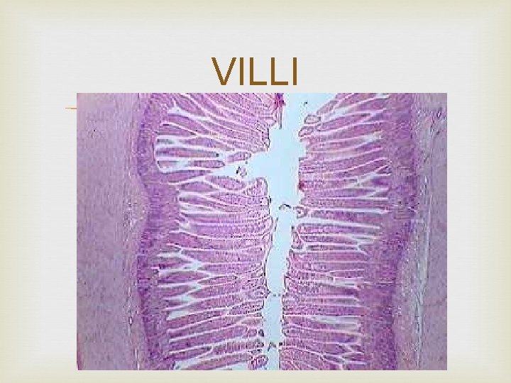 VILLI 