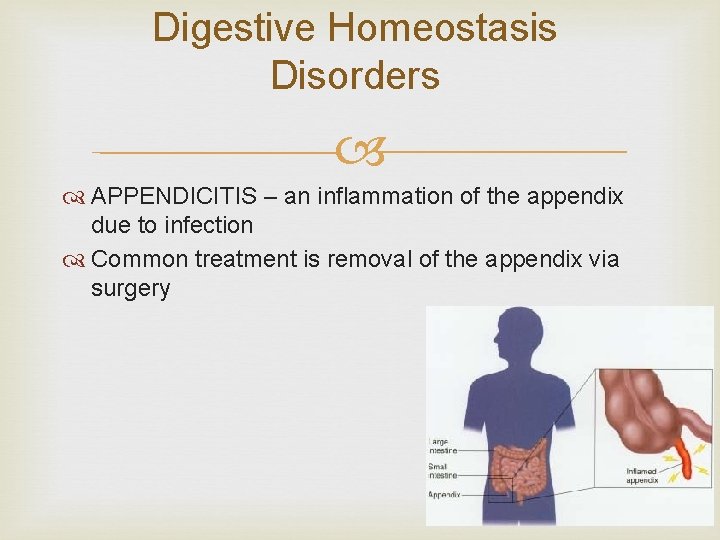 Digestive Homeostasis Disorders APPENDICITIS – an inflammation of the appendix due to infection Common