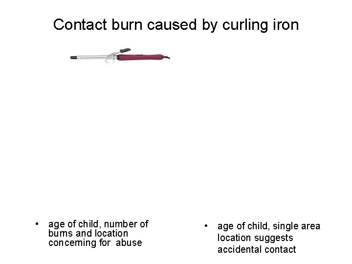 Contact burn caused by curling iron • age of child, number of burns and