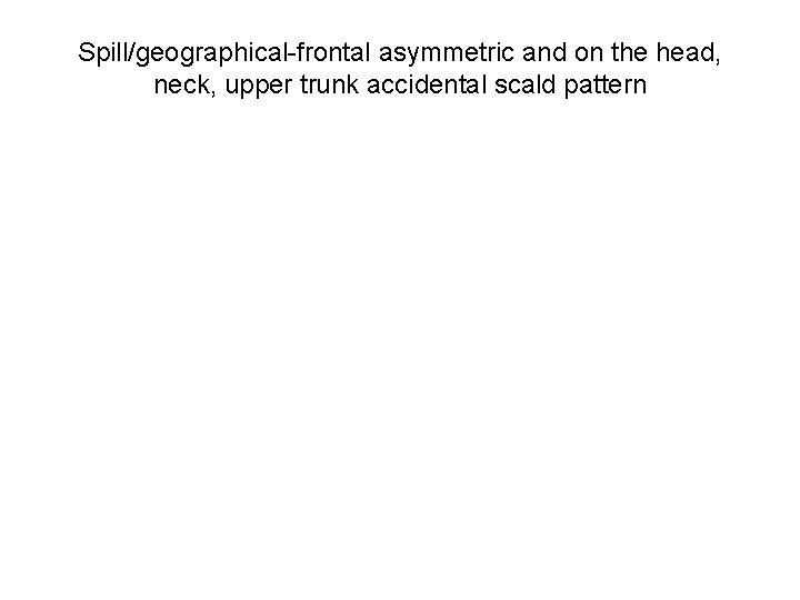 Spill/geographical-frontal asymmetric and on the head, neck, upper trunk accidental scald pattern 