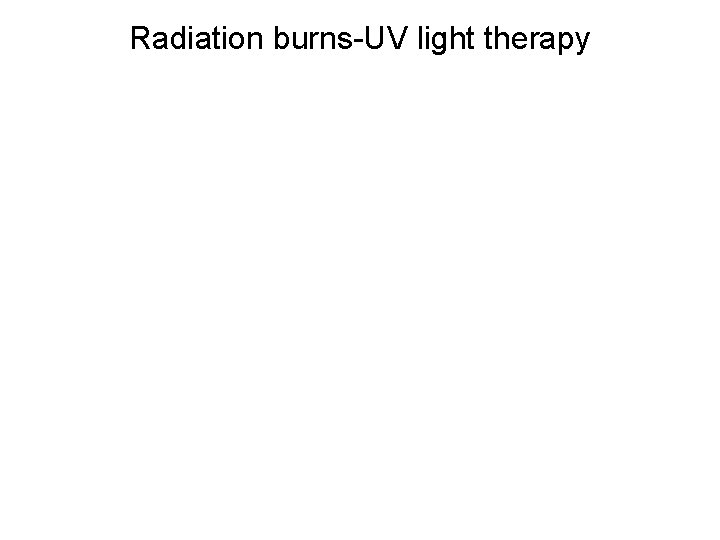 Radiation burns-UV light therapy 