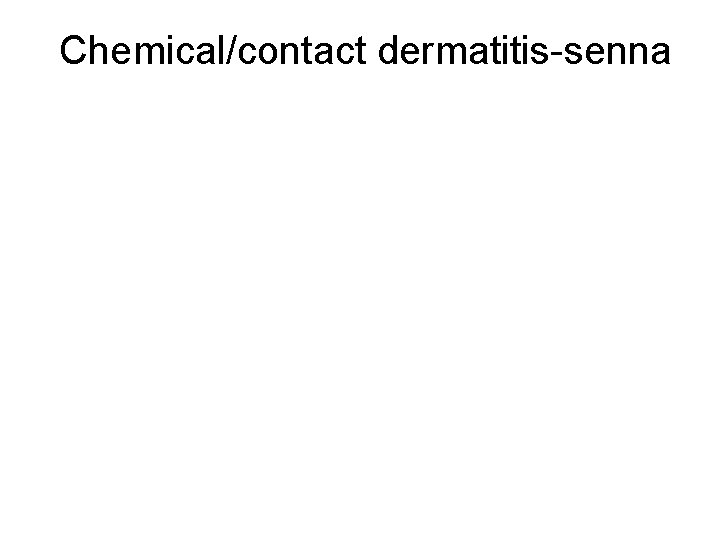 Chemical/contact dermatitis-senna 