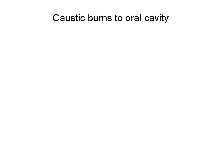 Caustic burns to oral cavity 