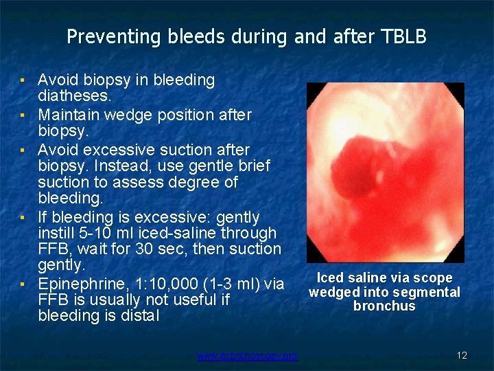 Preventing bleeds during and after TBLB ▪ Avoid biopsy in bleeding diatheses. ▪ Maintain