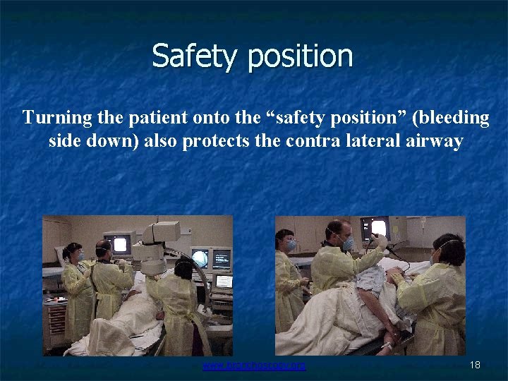 Safety position Turning the patient onto the “safety position” (bleeding side down) also protects