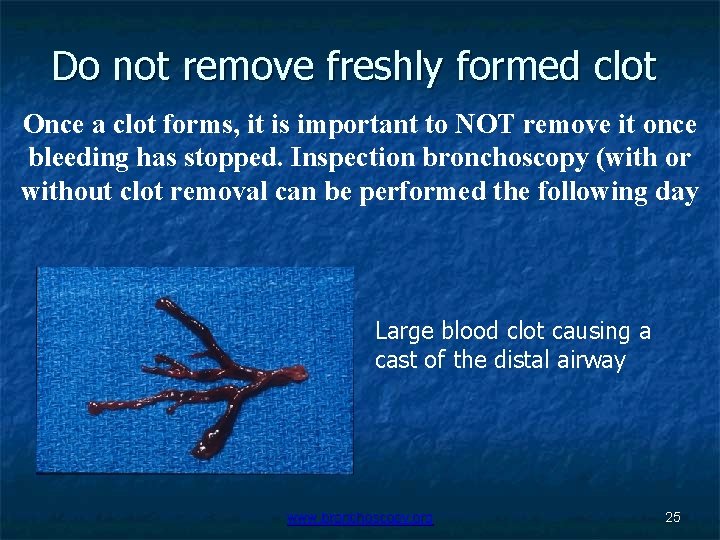 Do not remove freshly formed clot Once a clot forms, it is important to