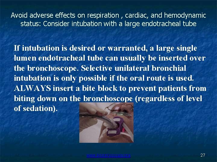 Avoid adverse effects on respiration , cardiac, and hemodynamic status: Consider intubation with a