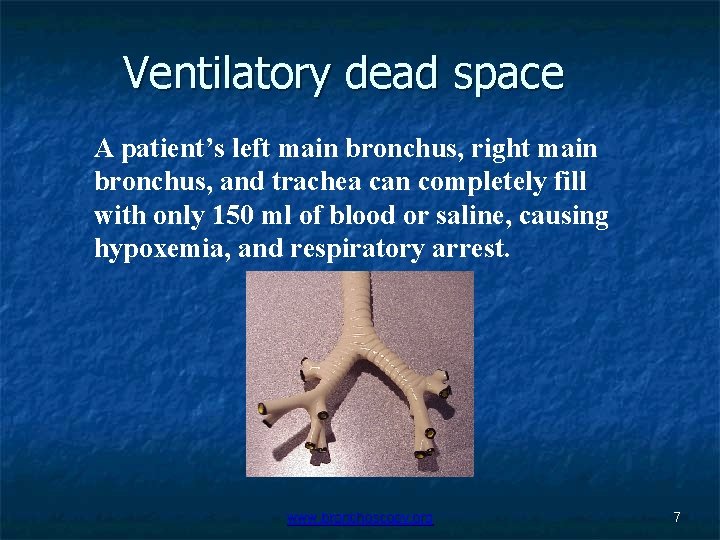 Ventilatory dead space A patient’s left main bronchus, right main bronchus, and trachea can