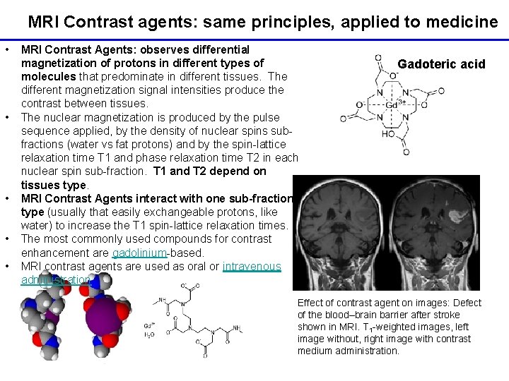 MRI Contrast agents: same principles, applied to medicine • • • MRI Contrast Agents: