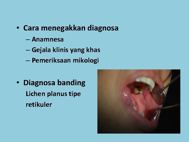  • Cara menegakkan diagnosa – Anamnesa – Gejala klinis yang khas – Pemeriksaan