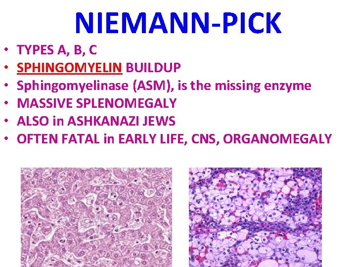  • • • NIEMANN-PICK TYPES A, B, C SPHINGOMYELIN BUILDUP Sphingomyelinase (ASM), is