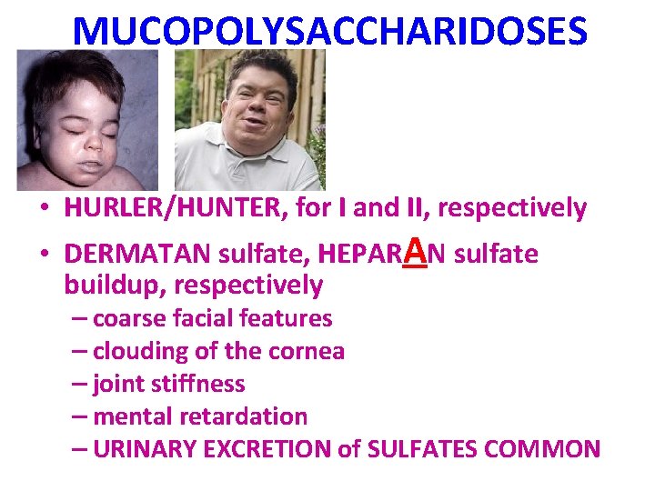 MUCOPOLYSACCHARIDOSES • HURLER/HUNTER, for I and II, respectively • DERMATAN sulfate, HEPARAN sulfate buildup,