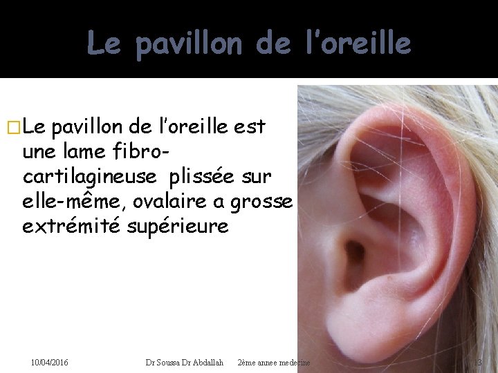 Le pavillon de l’oreille �Le pavillon de l’oreille est une lame fibrocartilagineuse plissée sur