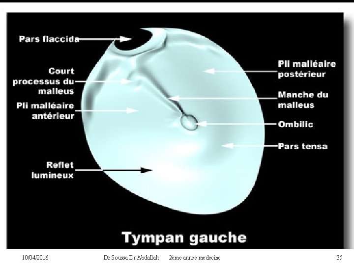 10/04/2016 Dr Soussa Dr Abdallah 2ème annee medecine 35 