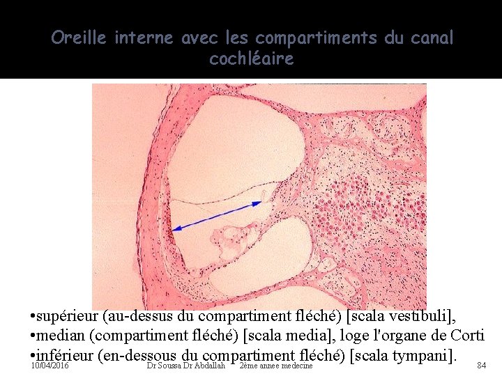 Oreille interne avec les compartiments du canal cochléaire • supérieur (au-dessus du compartiment fléché)