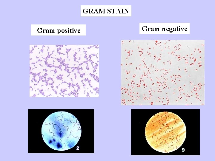 GRAM STAIN Gram positive Gram negative 