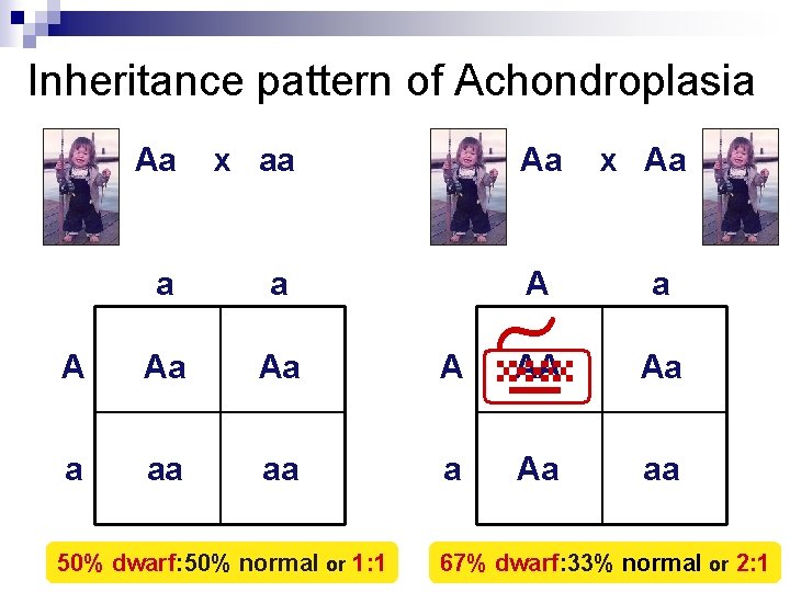 Inheritance pattern of Achondroplasia Aa x aa a a A Aa Aa A a