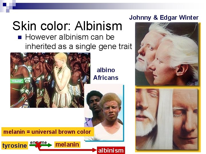 Skin color: Albinism n Johnny & Edgar Winter However albinism can be inherited as