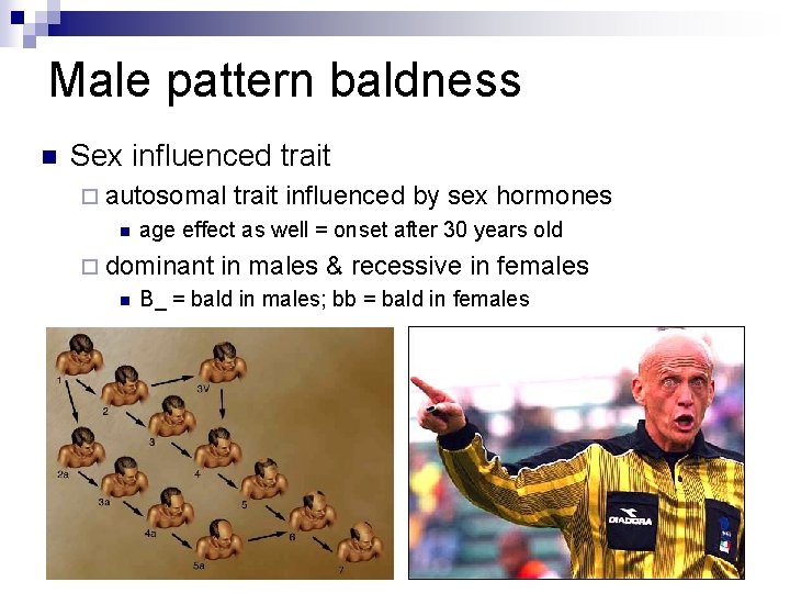 Male pattern baldness n Sex influenced trait ¨ autosomal n age effect as well
