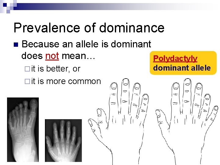 Prevalence of dominance n Because an allele is dominant does not mean… Polydactyly ¨