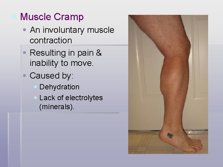 § Muscle Cramp § An involuntary muscle contraction § Resulting in pain & inability