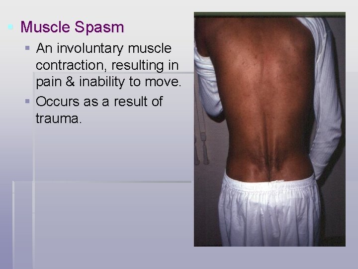 § Muscle Spasm § An involuntary muscle contraction, resulting in pain & inability to