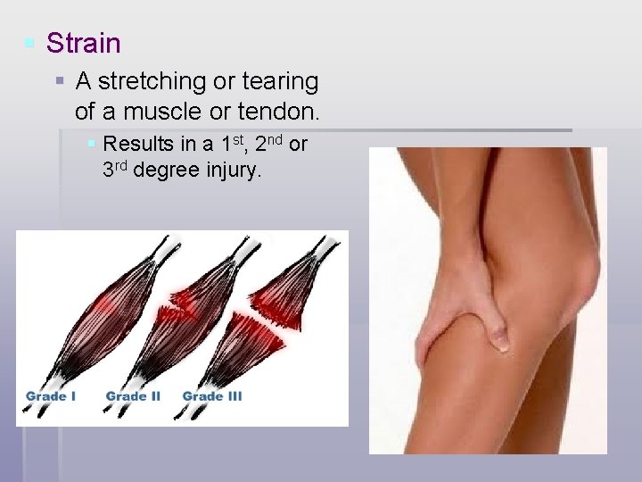 § Strain § A stretching or tearing of a muscle or tendon. § Results