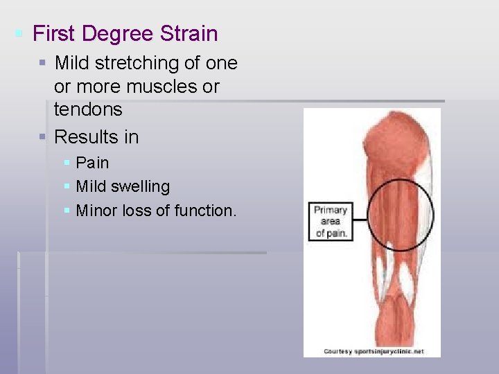 § First Degree Strain § Mild stretching of one or more muscles or tendons