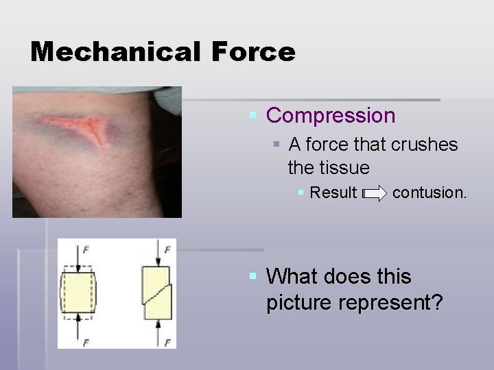 Evaluation Assessment Mechanical Forces Muscle Injuries Objectives Identify