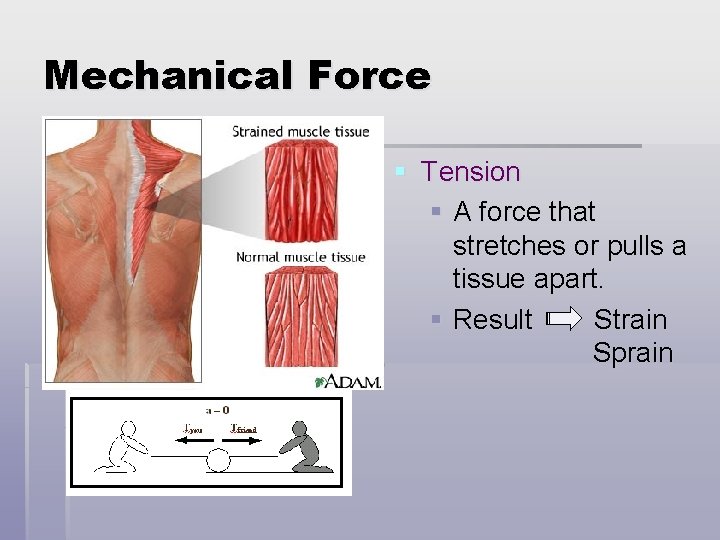 Mechanical Force § Tension § A force that stretches or pulls a tissue apart.