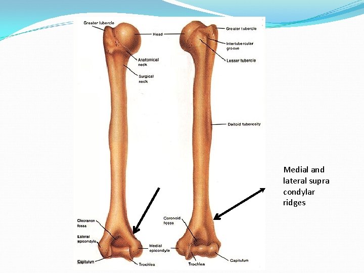 Medial and lateral supra condylar ridges 