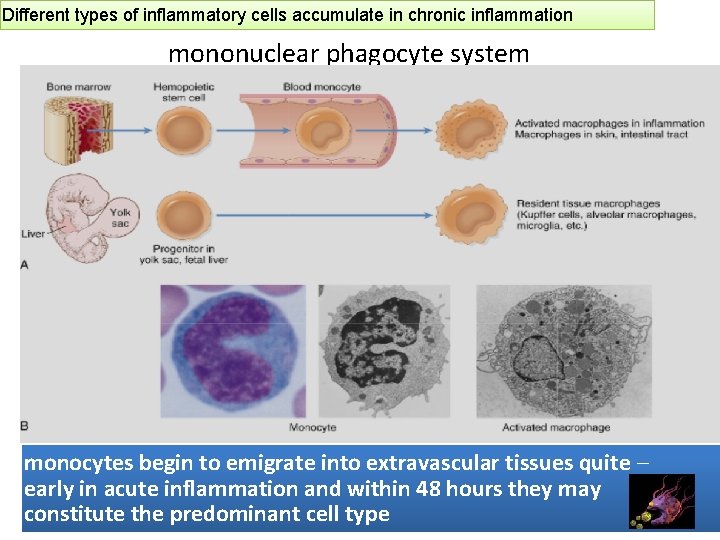 Different types of inflammatory cells accumulate in chronic inflammation mononuclear phagocyte system monocytes begin