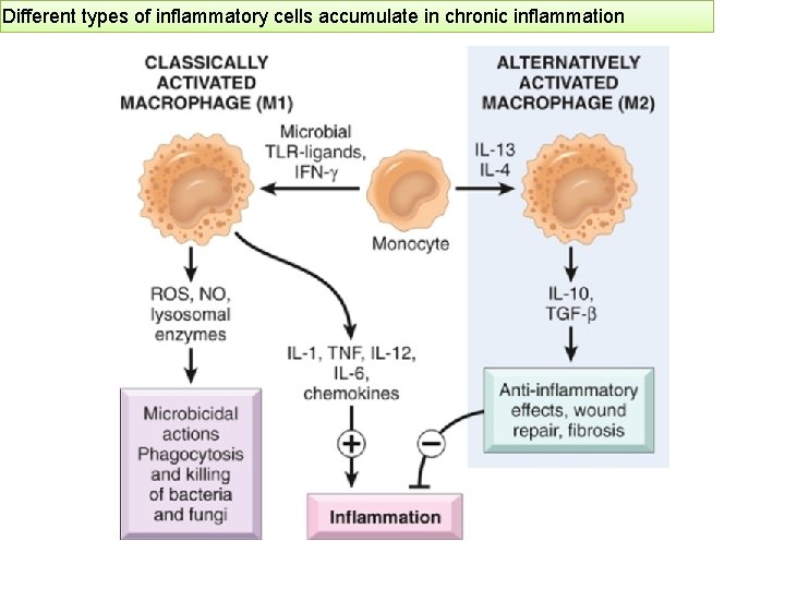 Different types of inflammatory cells accumulate in chronic inflammation 