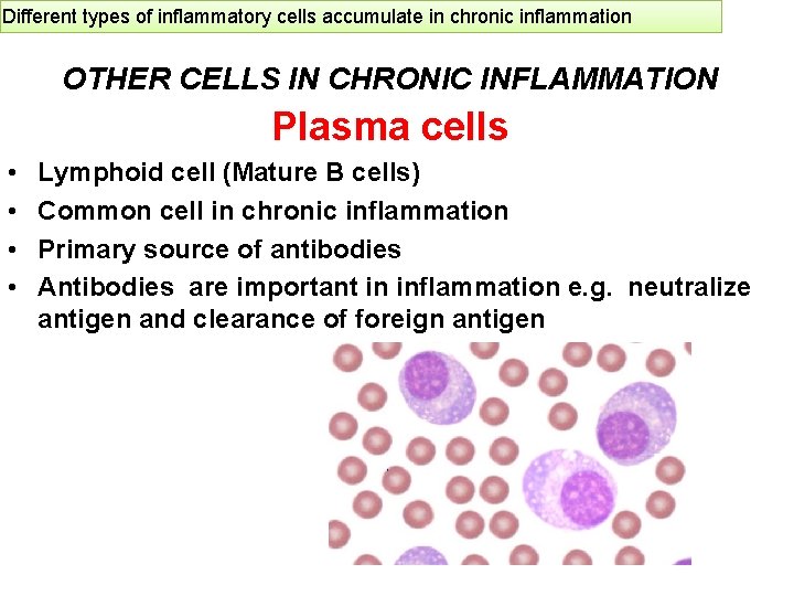 Different types of inflammatory cells accumulate in chronic inflammation OTHER CELLS IN CHRONIC INFLAMMATION