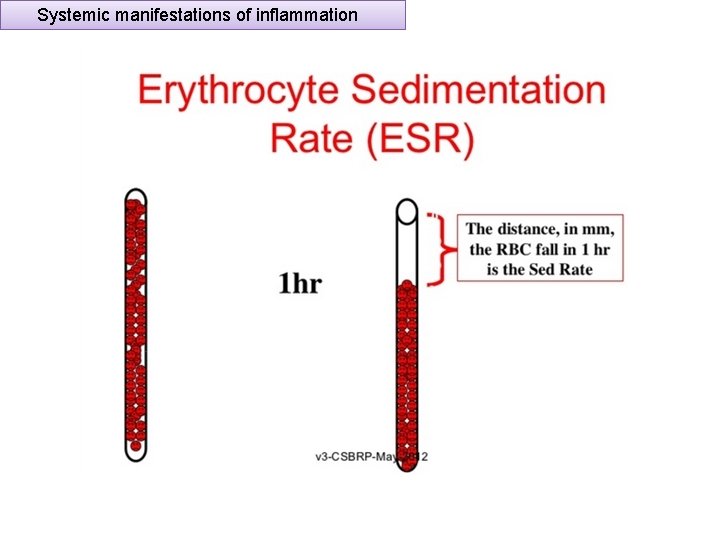 Systemic manifestations of inflammation 