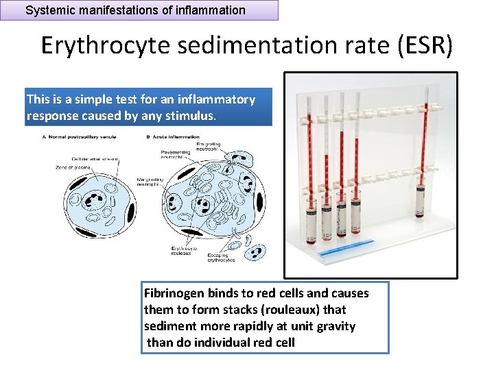 Systemic manifestations of inflammation Erythrocyte sedimentation rate (ESR) This is a simple test for