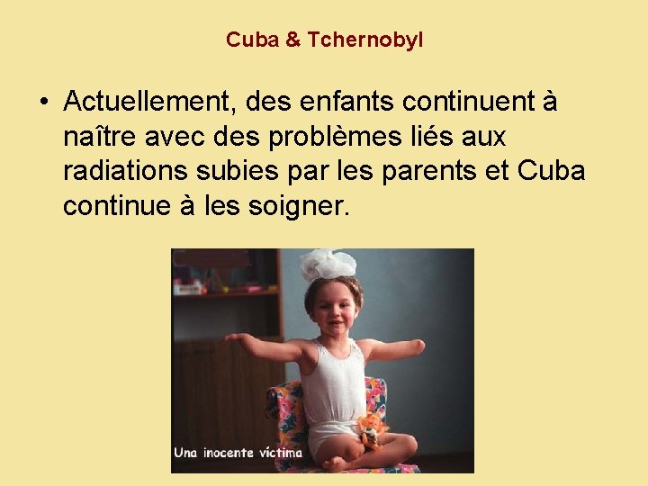 Cuba & Tchernobyl • Actuellement, des enfants continuent à naître avec des problèmes liés
