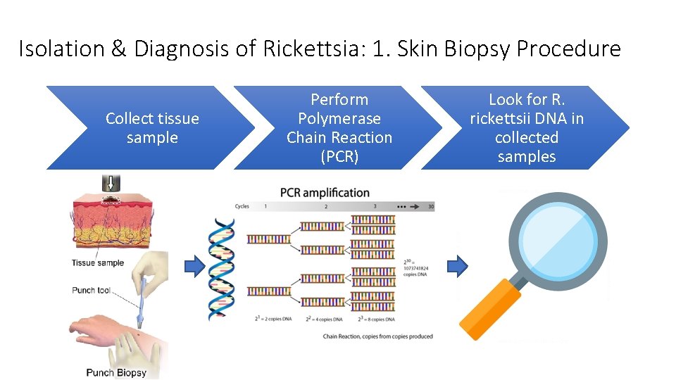 Isolation & Diagnosis of Rickettsia: 1. Skin Biopsy Procedure Collect tissue sample Perform Polymerase