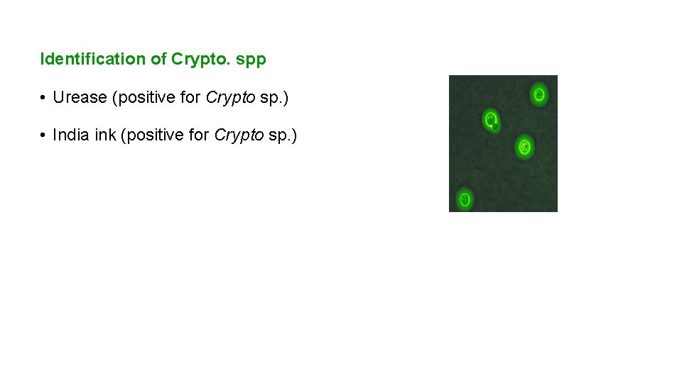 Identification of Crypto. spp • Urease (positive for Crypto sp. ) • India ink