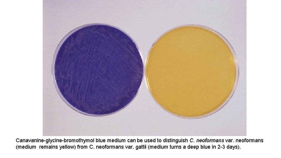 Canavanine-glycine-bromothymol blue medium can be used to distinguish C. neoformans var. neoformans (medium remains