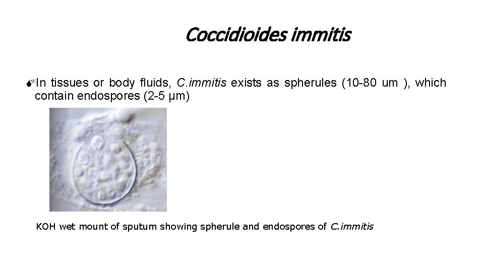 Coccidioides immitis MIn tissues or body fluids, C. immitis exists as spherules (10 -80