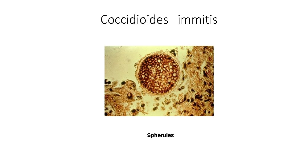 Coccidioides immitis Spherules 