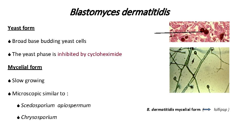 Blastomyces dermatitidis Yeast form S Broad base budding yeast cells S The yeast phase