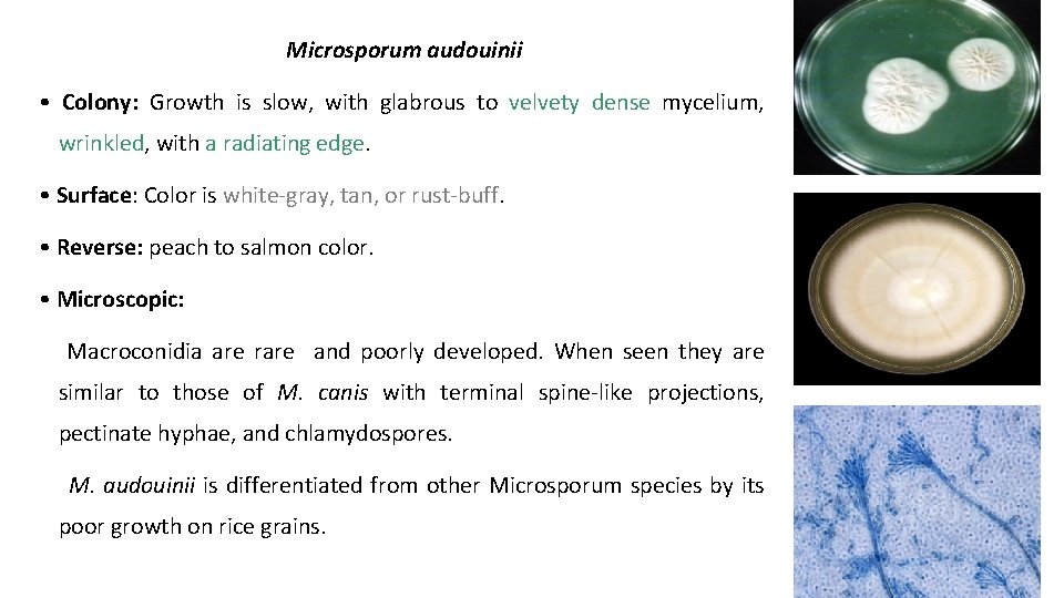 Microsporum audouinii • Colony: Growth is slow, with glabrous to velvety dense mycelium, wrinkled,