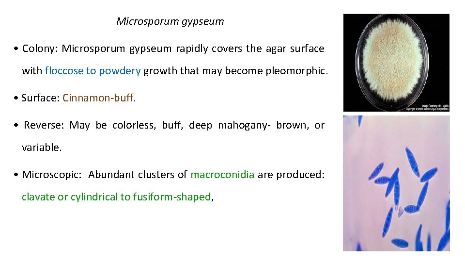 Microsporum gypseum • Colony: Microsporum gypseum rapidly covers the agar surface with floccose to