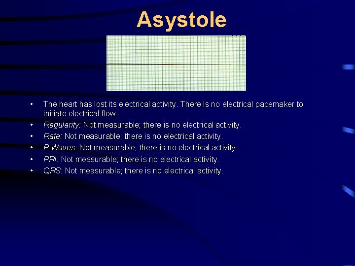 Asystole • • • The heart has lost its electrical activity. There is no